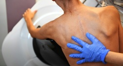 Mammografiescreening ab Juli auch für Frauen bis 75 Jahre möglich