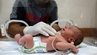 Krankenhaus im Gazastreifen: Baby aus Bauch von getöteter Schwangerer gerettet