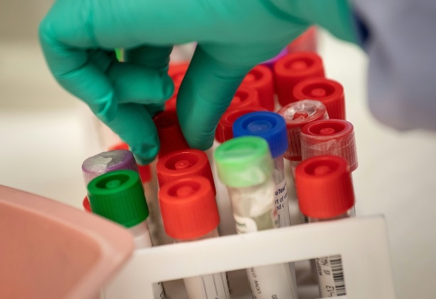 Bild vergrößern: WHO hebt höchste Alarmstufe für Infektionskrankheit Mpox auf