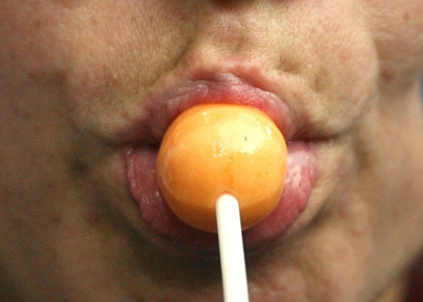 Bild vergrößern: Grippe-Schnelltest mit Lolli und Kaugummi: Forscher entwickeln neue Diagnostik