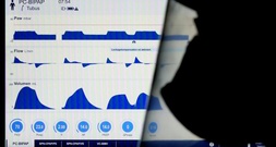 Männer sterben in Deutschland im Schnitt fast fünf Jahre früher als Frauen