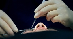 Boom von Abnehmspritzen verändert Schönheitschirurgie: Mehr Straffungseingriffe