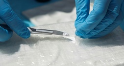 Mann mit hundert Päckchen Kokain in Körper an Flughafen Berlin-Brandenburg erwischt