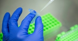 Gentechnik: Agrarindustrie begrüßt EU-Einigung - Kritik von Umweltschützern