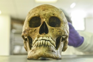 Rheinland-Pfalz: Kinder finden menschlichen Schädel in Gebüsch neben Spielplatz