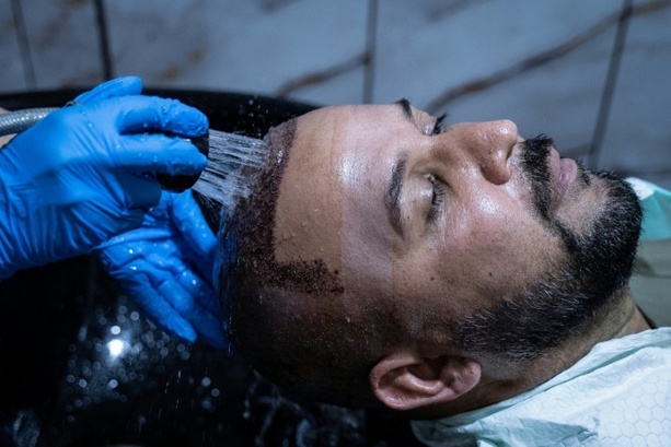 Bild vergr&ouml;&szlig;ern: Zahl der Schönheits-OPs bei Männern fast verdoppelt