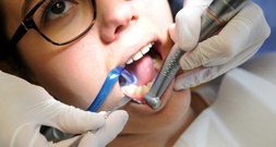 Zahnbehandlungen selbst zahlen: CDU-Wirtschaftsrat will Sozialleistungen streichen