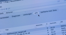 Umfrage: Elektronische Patientenakte findet wenig Anklang - Forderungen an Politik
