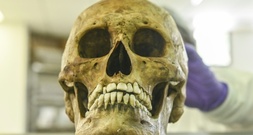 Identität von in Rheinland-Pfalz gefundenem Schädel aufgeklärt