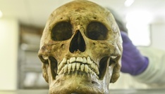 Identität von in Rheinland-Pfalz gefundenem Schädel aufgeklärt