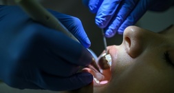 Gesundheitsstudie: Großteil der Kinder in Deutschland ist kariesfrei