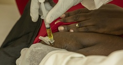 USA finanzieren mehr HIV-Prophylaxe-Injektionen in armen Ländern