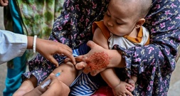 Bangladesch verzeichnet mehr als 220 Todesfälle durch Masern seit März