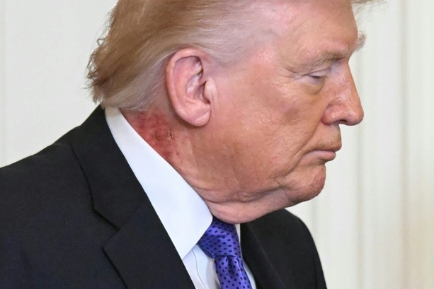 Bild vergr&ouml;&szlig;ern: Trump: Gesundheitscheck ist perfekt verlaufen