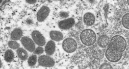 Mpox-Viren im Gepäck: Ermittlungsverfahren gegen zwei Virologen von US-Institut