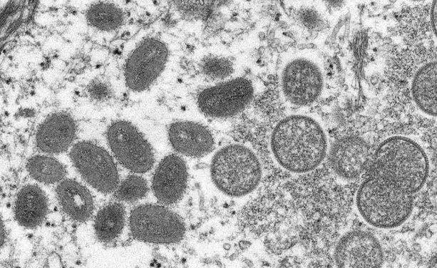 Bild vergr&ouml;&szlig;ern: Mpox-Viren im Gepäck: Ermittlungsverfahren gegen zwei Virologen von US-Institut