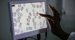 Globaler Fonds warnt vor Folgen von weniger Hilfsgeldern für Kampf gegen Malaria
