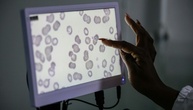 Globaler Fonds warnt vor Folgen von weniger Hilfsgeldern für Kampf gegen Malaria
