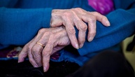 Alzheimer-Experten: Fast 1,8 Millionen Menschen in Deutschland leben mit Demenz